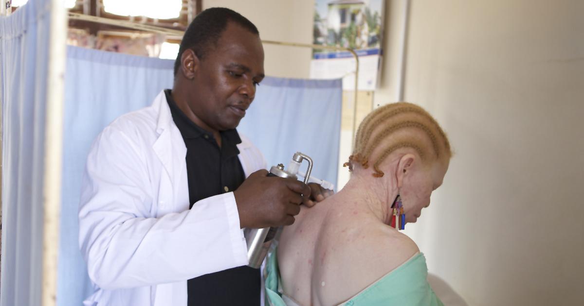 Association decries spate of skin cancer among albinos