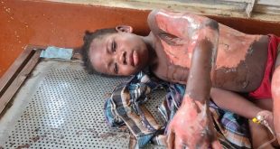Man sets young girl ablaze in Bauchi, claims she is a witch sent to kill him