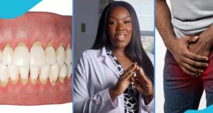Bad oral health causes impotence, visit a dentist now – Dr Louisa warns men