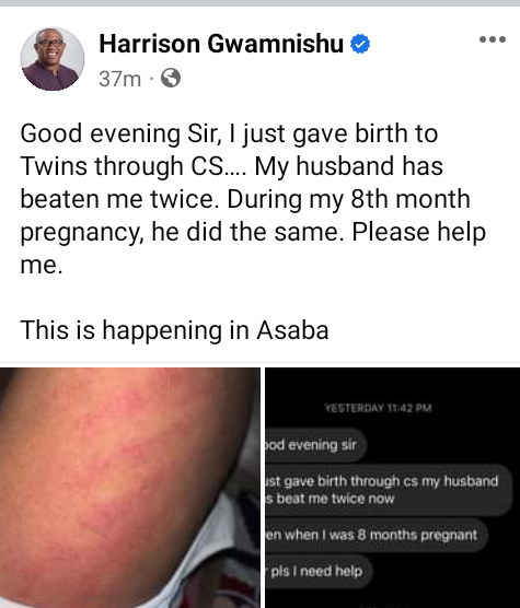 "I just gave birth to twins through CS and my husband has beaten me twice" - Nigerian woman cries out for help