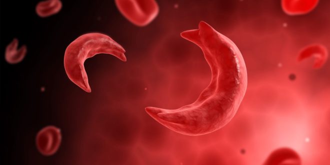 Navigating Life with Sickle Cell Disorder: Understanding the Unseen Struggles