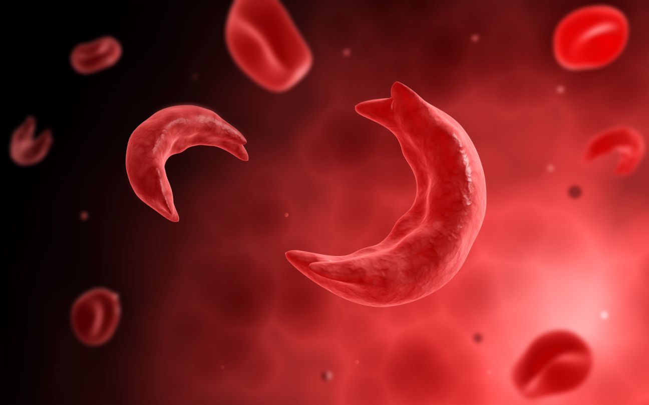 Navigating Life with Sickle Cell Disorder: Understanding the Unseen Struggles