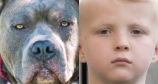 7 year old boy mauled by pitbull dog as he played with his friends at park after school