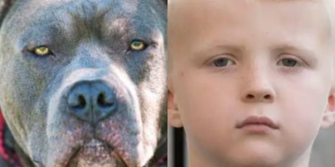 7 year old boy mauled by pitbull dog as he played with his friends at park after school