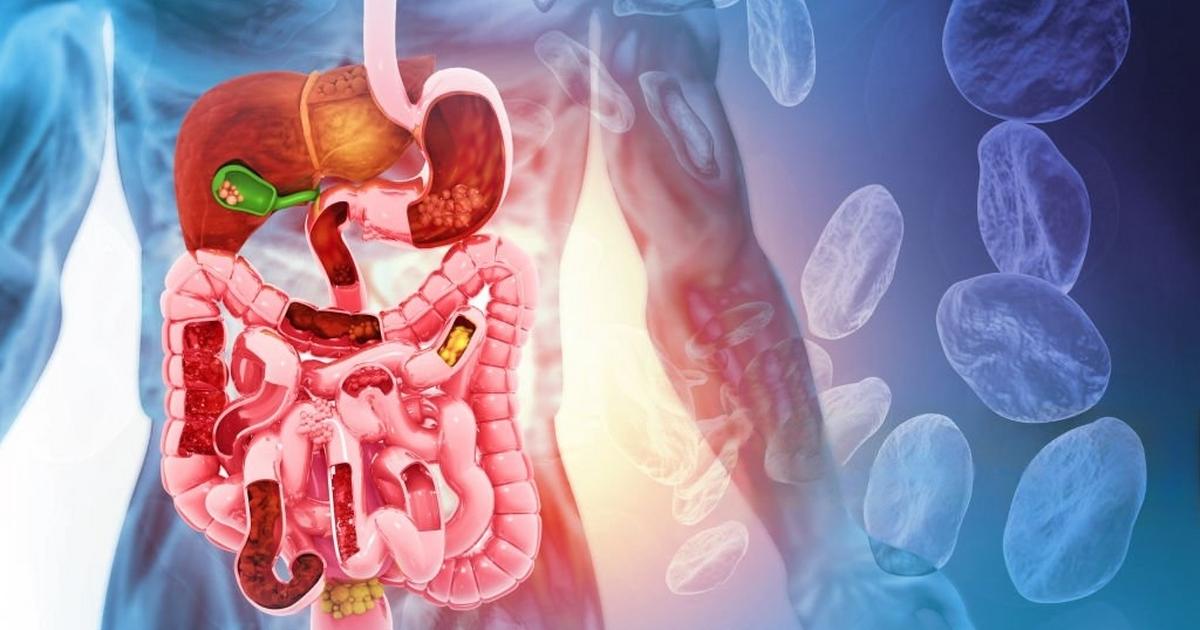 8 effective natural laxatives for stomach relief