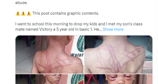 Heartbreaking photos of 5-year-old boy with cane marks all over his body after he was allegedly assaulted by his aunt and her boyfriend in Port Harcourt