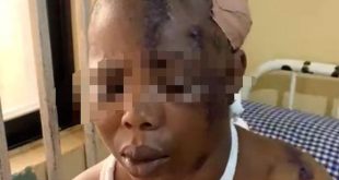 Husband machetes wife over sexual harassment allegation