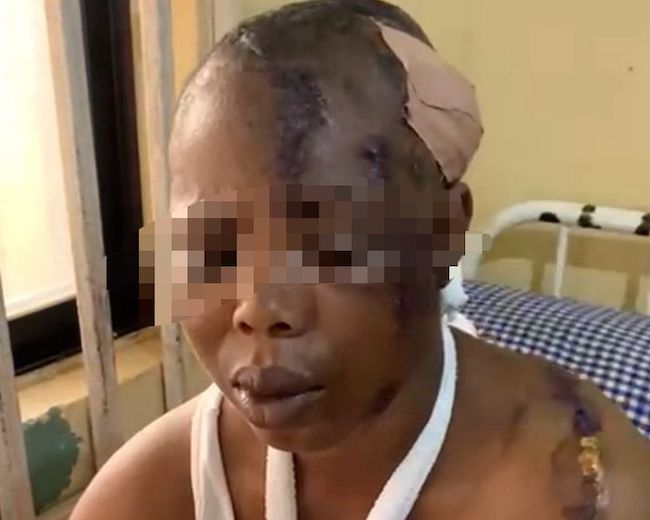 Husband machetes wife over sexual harassment allegation