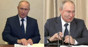 Vladimir Putin's swollen 'butt filler' cheeks spark more plastic surgery rumours