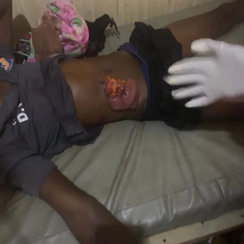 Officials and crew member injured as gunmen attack Akure football team on Ore-Benin expressway