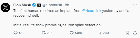 Elon Musk reveals first human patient has received a brain implant from his startup Neuralink