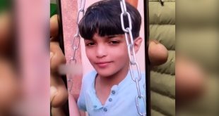 Injured Palestinian boy in Gaza no longer recognises his own face