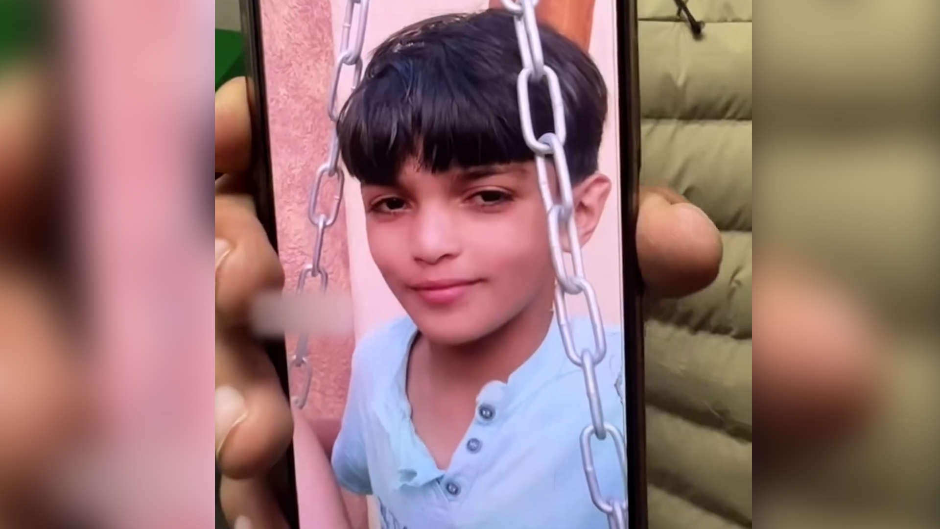 Injured Palestinian boy in Gaza no longer recognises his own face