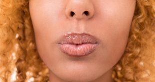 All you need to know about herpes, the STD that can be spread through kissing