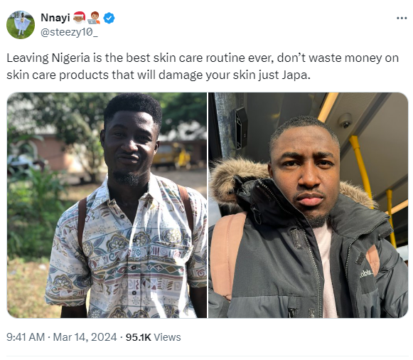 Leaving Nigeria is the best skin care routine ever- Nigerian man in the diaspora says as he shares his before and after photos