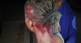UNIMAID student viciously attacks 21-year-old lady for rejecting his love proposal