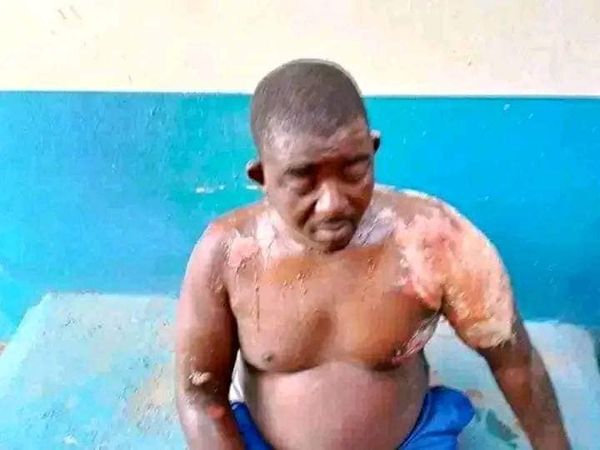Update: Newly wedded wife bathes her husband with hot water for stopping her from calling men