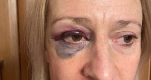 Woman avoids jail after beating sister-in-law during Boxing Day fight