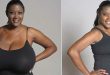 Can breasts regrow? 5 surprising facts about breast reduction surgery
