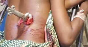Suspected phone thief stabs young woman in Yobe