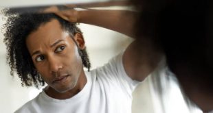 3 ways you can restore your hairline