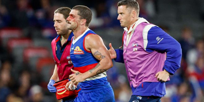 Concussed Bulldogs star finally learns footballing fate
