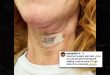 Actress Kathy Griffin shares first Instagram photo after second vocal chord surgery
