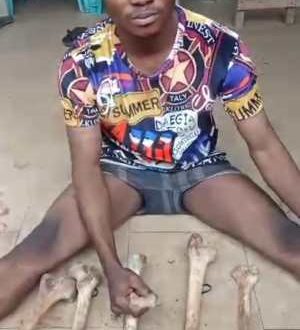Herbalist arrested with 11 human bones in Anambra, says he uses them to prepare ?high-quality charms? for his clients