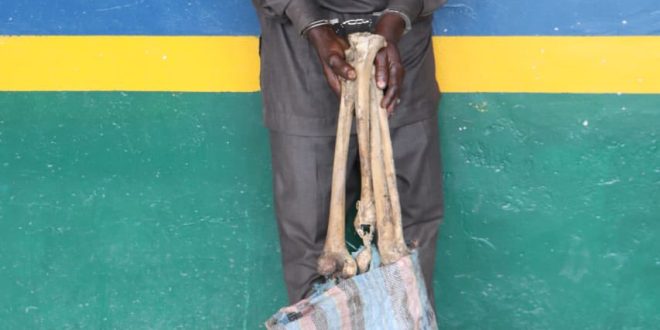 Man arrested with human skull and bones in Abuja, reveals he intended to sell them for N600,000