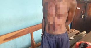 Suspected ritualist arrested for attempted murder of 10-year-old boy in Kwara
