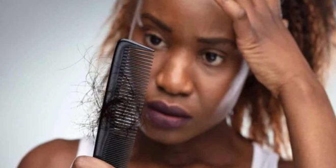 This common ingredient in shampoos causes severe hair loss in Africans