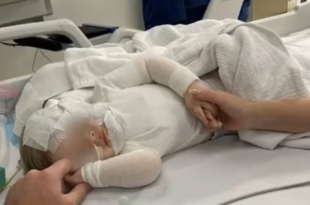 ?It?s affected my mental health for the rest of my life"- Mum in ag0ny after learning that man who poured hot coffee on her baby resulting in 4 surgeries has fled the country