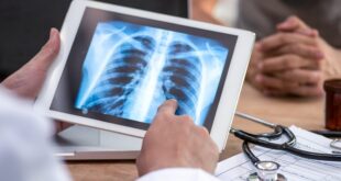 Tech Life - Artificial intelligence helps doctors detect lung cancer - BBC Sounds