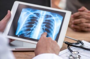 Tech Life - Artificial intelligence helps doctors detect lung cancer - BBC Sounds