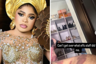 Bobrisky shares graphic photos of injury he sustained from his encounter with EFCC officials