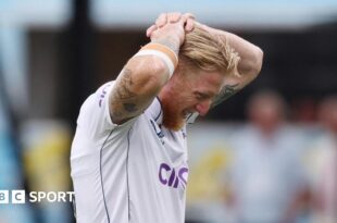 England captain Ben Stokes puts his hands on his head as he leaves the field injured