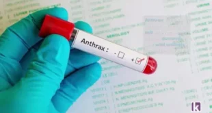 FG alerts Nigerians over outbreak of anthrax in Zamfara